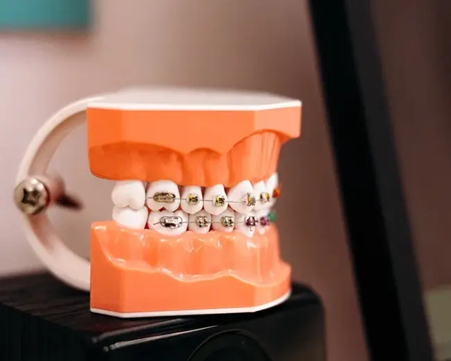 Rectangle_31 (1).webp