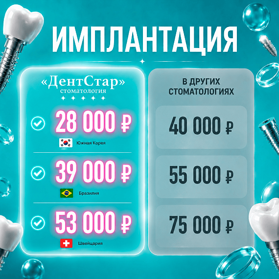 Имплантация